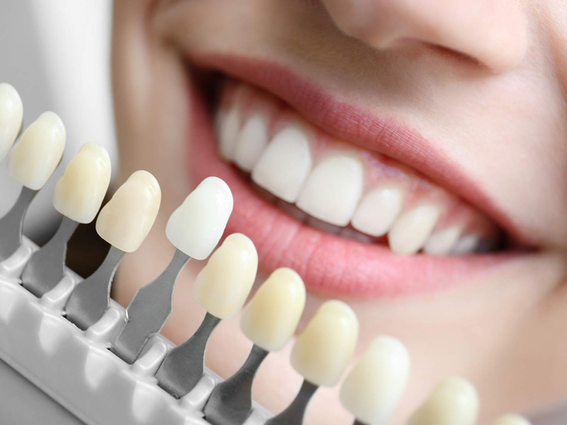 Cosmetic Dentistry services