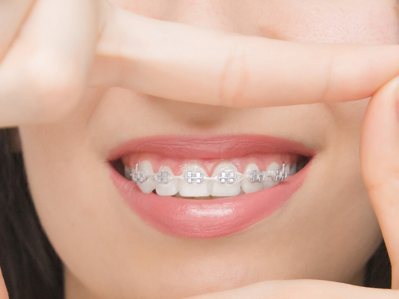 Orthodontics services